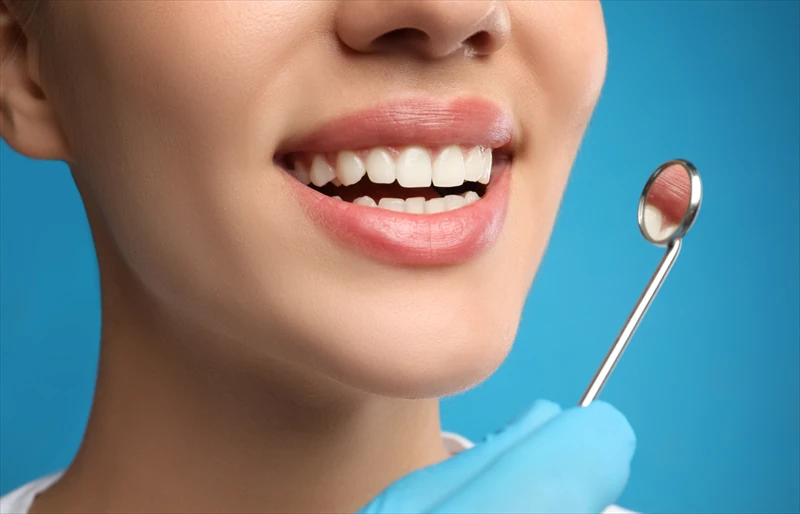 Smile Makeover in Rochester: Combining Veneers, Whitening, and Bonding Cosmetic image