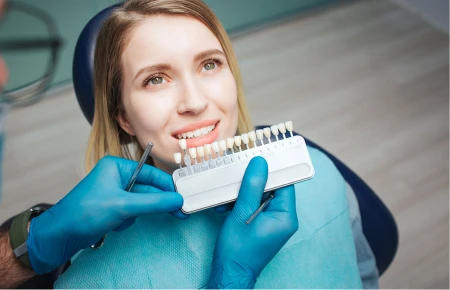 Dental Veneers image