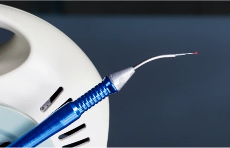 The Concerns and Risks Associated with Laser Dentistry image
