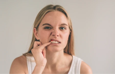 Gum Disease image