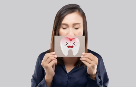 How Cavities Are Formed and How They Can Be Prevented image