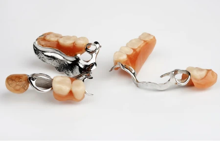Types of Dentures image