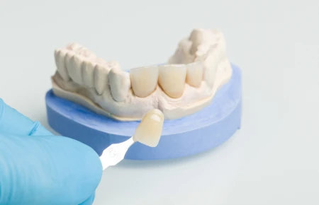 Biocompatible Materials: The Next Frontier in Dental Care image