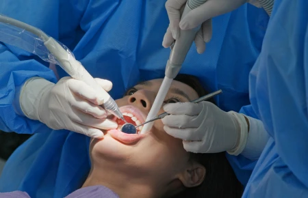 Dental Implant Surgery image