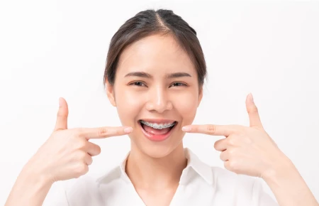Advices for People with Braces image