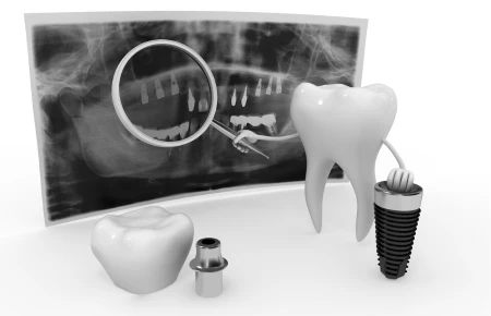 The Evolution of Dental Technology: How Rochester Hills Dentistry Stays at the Forefront image