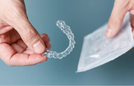 AI in Invisalign Treatment Planning image