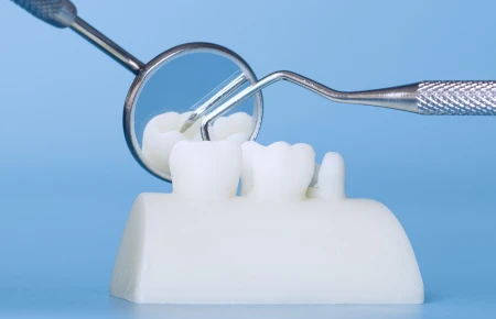 Comparing Implant Restoration Materials: Which Is Best for You image