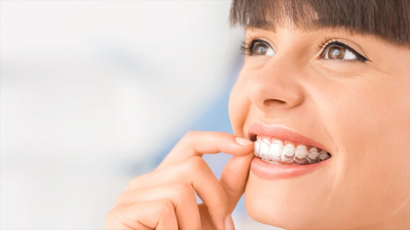 Choosing Invisalign in NY: What to Expect and Why It's a Game-Changer